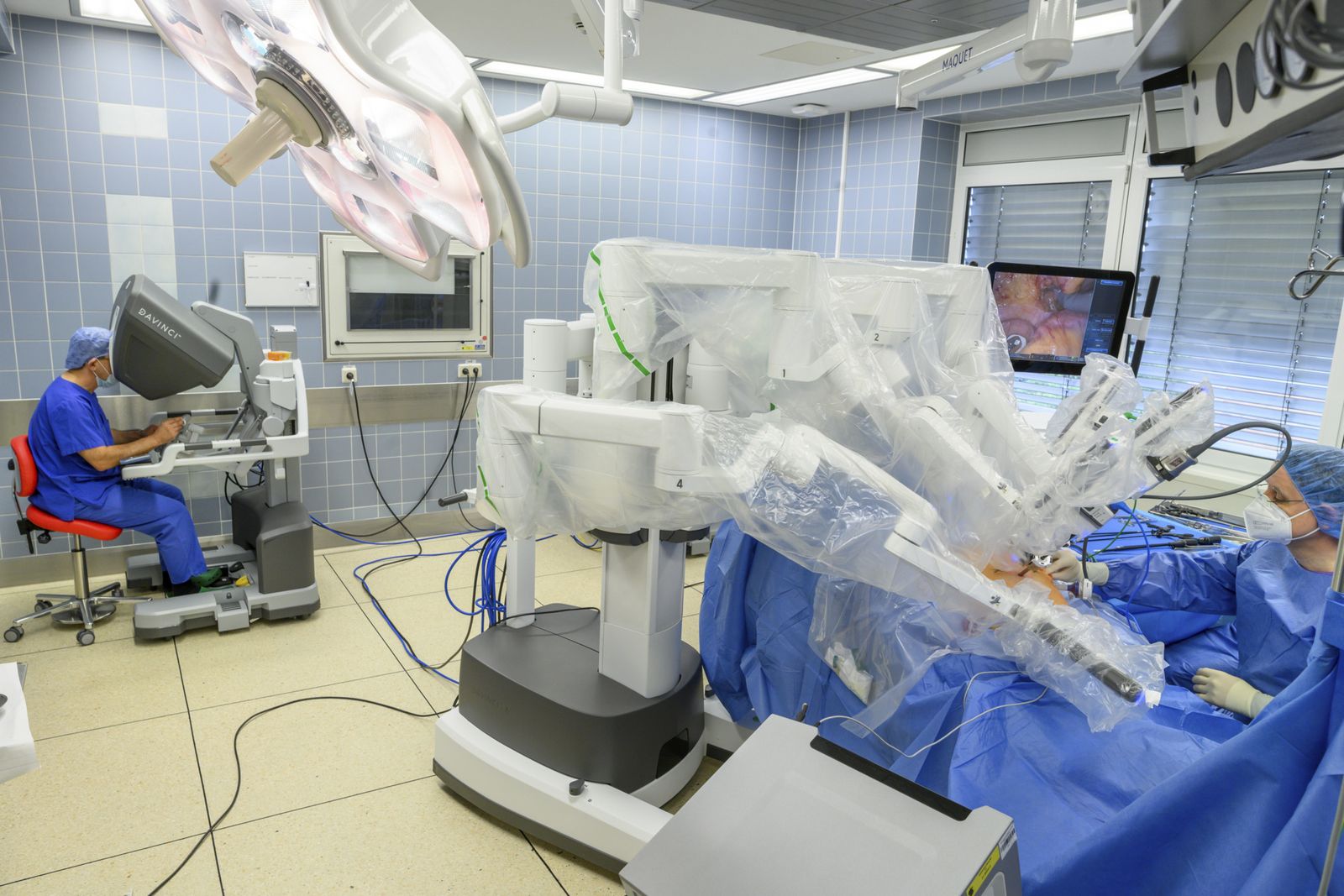 Operation mit dem roboter-assistierten System Da Vinci